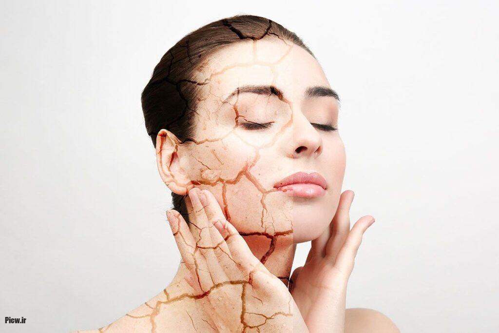 ماسک ضدخشکی پوست