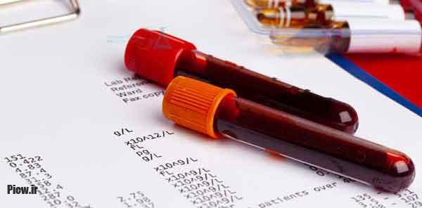 داروها و مکملهای قبل از آزمایش خون