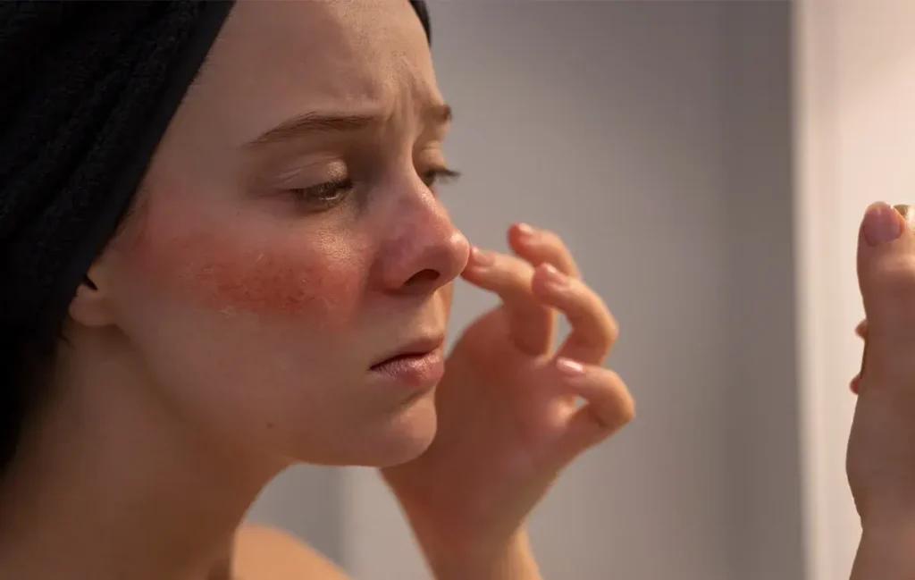 ماسک ضدقرمزی صورت