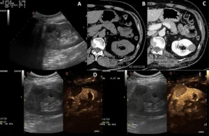 تفاوت رادیولوژی و سونوگرافی